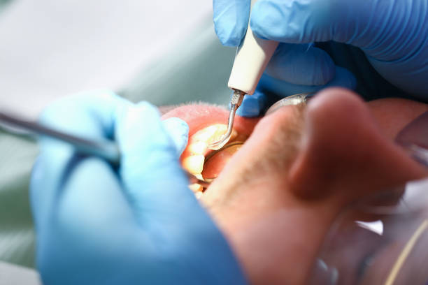 Best Emergency Treatment for Toothache in Tigard, OR